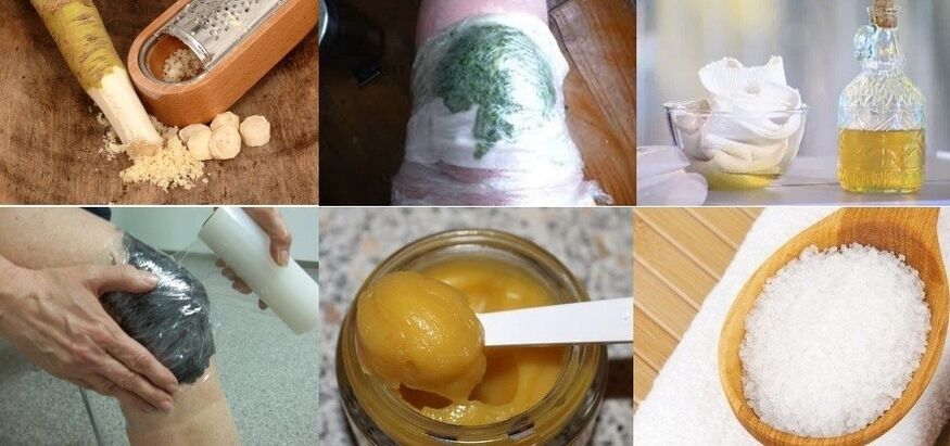 Remedios populares para la artrosis de la articulación de la rodilla.