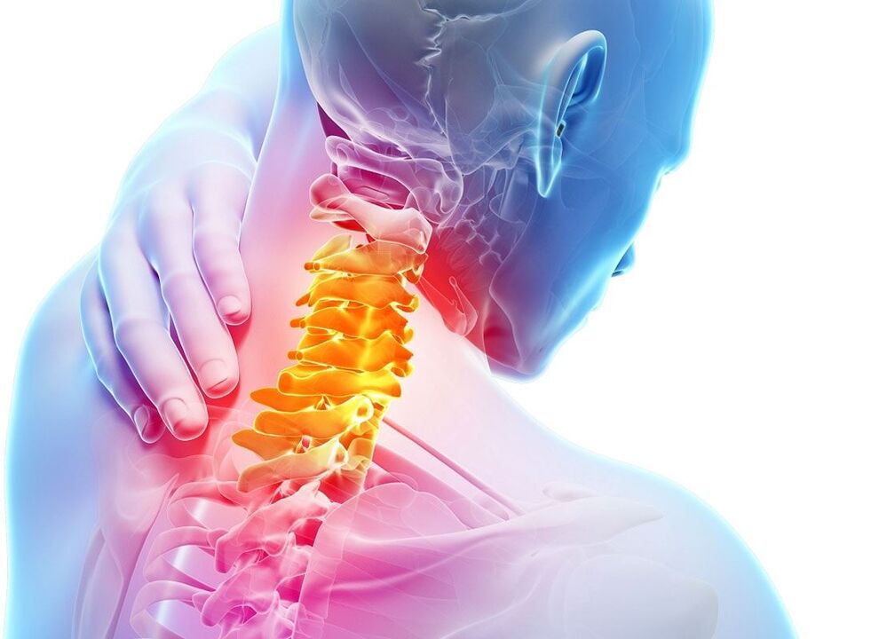 osteocondrosis de la columna cervical